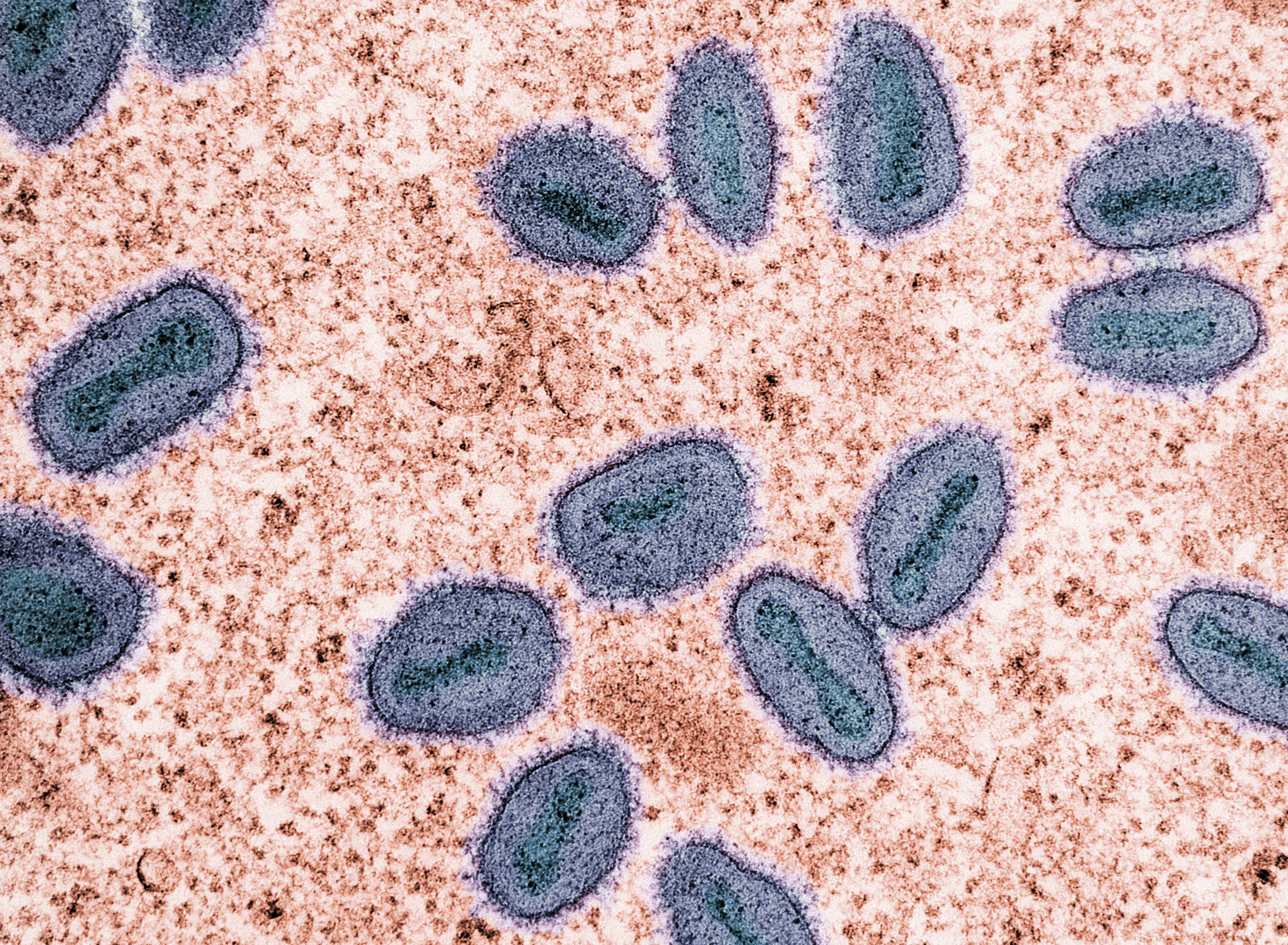 Hantavirus spreads to Europe in alarming update after cruise deaths