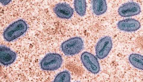 Hantavirus spreads to Europe in alarming update after cruise deaths