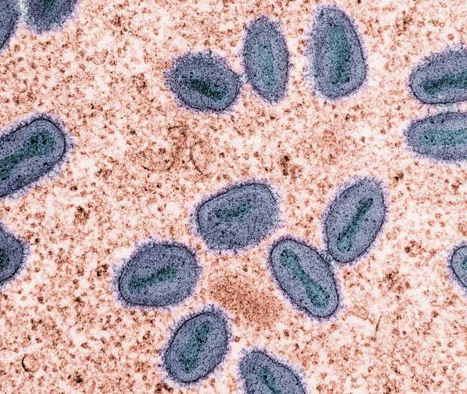 Hantavirus spreads to Europe in alarming update after cruise deaths